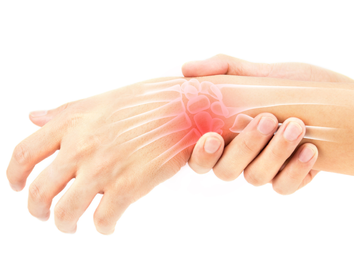 🖐️ KézErő – az ÍzületŐr™ kompressziós kesztyűje