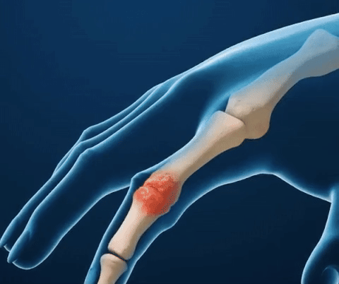 🖐️ KézErő – az ÍzületŐr™ kompressziós kesztyűje